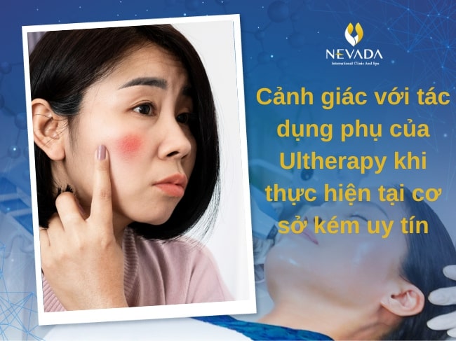 làm ultherapy có đau không, tác dụng phụ của, chăm sóc da sau khi làm