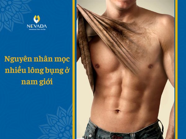 Nguyên nhân mọc nhiều lông bụng ở nam giới – Xem tướng đàn ông lông bụng