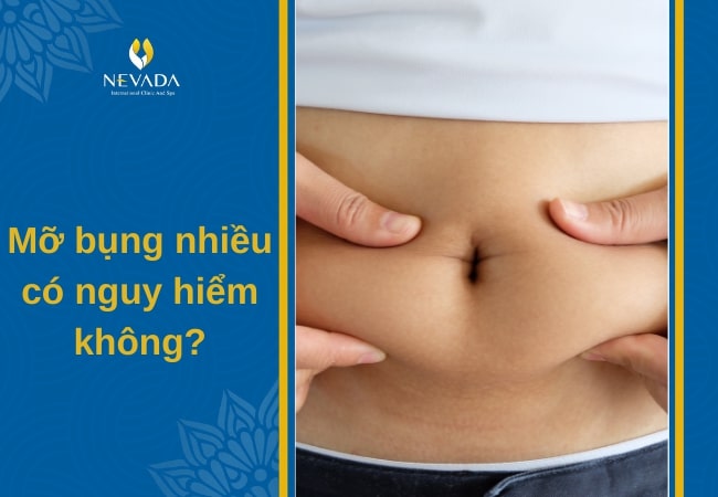 béo bụng có nguy hiểm không, mỡ bụng nhiều có nguy hiểm không, mỡ bụng nguy hiểm, béo bụng nguy hiểm, mỡ bụng có nguy hiểm không, giảm mỡ bụng nguy hiểm, bụng mỡ có nguy hiểm