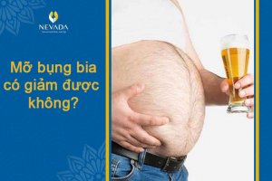 Chuyên gia giải đáp: Mỡ bụng bia có giảm được không?