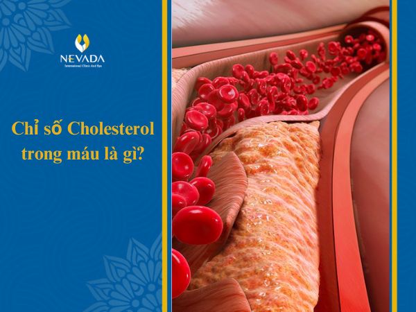 Chỉ số Cholesterol trong máu là gì? Làm thế nào để kiểm soát lượng Cholesterol trong cơ thể?