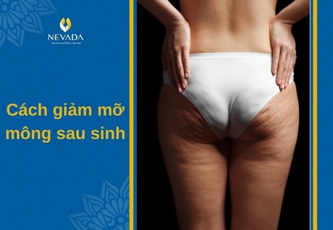 cách giảm mỡ mông sau sinh, giảm mông sau sinh, giảm mỡ mông sau sinh, cách giảm mông sau sinh, cách giảm mỡ bụng và mông sau sinh