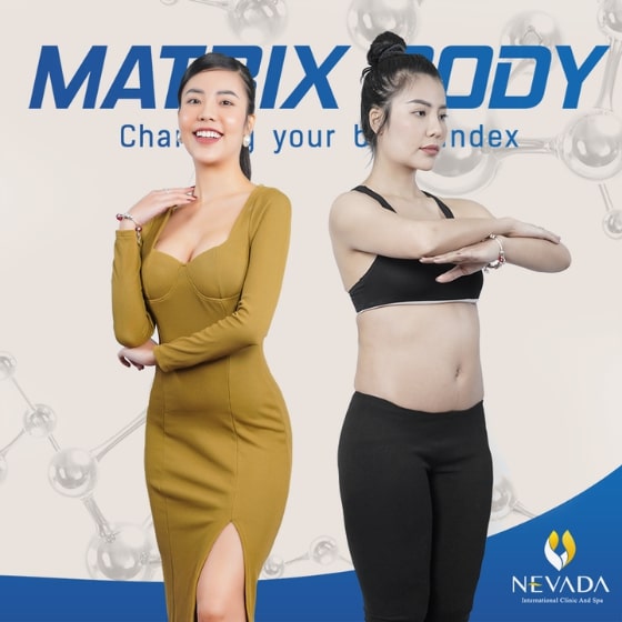 Công nghệ giảm béo đa điểm Matrix Body