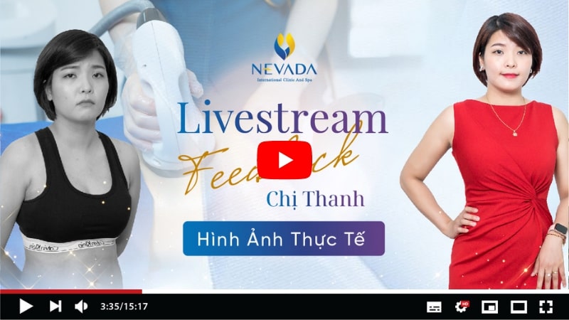Livestream Feedback của chị Thanh sau giảm béo