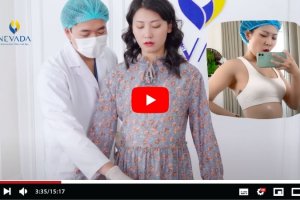 Bụng Bự Vlog: Vạch trần sự thật đằng sau công nghệ giảm béo không phẫu thuật – 40 phút giảm 15 – 20cm mỡ!