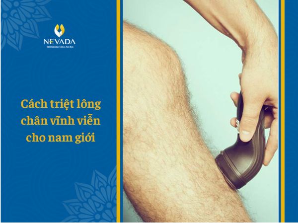 Cách triệt lông chân vĩnh viễn cho nam giới giúp tẩy sạch lông hiệu quả nhất
