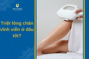 Triệt lông chân vĩnh viễn ở đâu tốt tại Hà Nội và TPHCM?