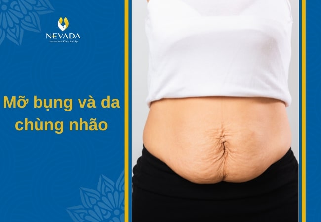 cách giảm mỡ bụng sau sinh 4 tháng, giảm mỡ bụng sau sinh 4 tháng, giảm cân sau sinh 4 tháng, giảm cân sau sinh mổ 4 tháng