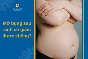 Mỡ bụng sau sinh có giảm được không?