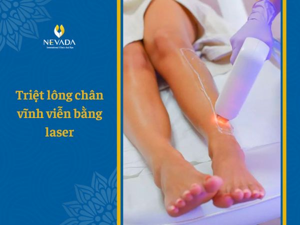 Bật mí thông tin về phương pháp triệt lông chân vĩnh viễn bằng laser từ chuyên gia