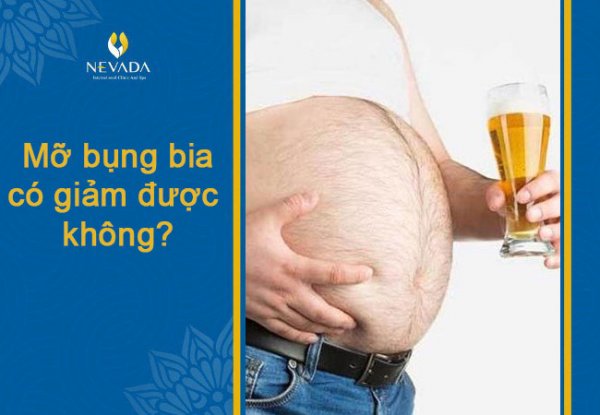 Bụng bia phải làm sao? Cách giảm bụng bia biến mất sau 30 ngày cho nam cực nhanh và hiệu quả nhất