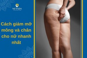 Khám phá cách giảm mỡ mông và chân cho nữ nhanh nhất