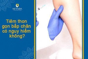 Chuyên gia giải đáp: Tiêm thon gọn bắp chân có nguy hiểm không?