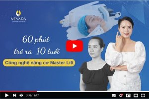 Nâng Cơ Master Lift: Chân Ái Cho Làn Da Mặt Tuổi 30