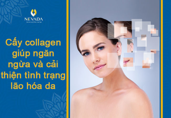 cấy collagen căng bóng da có tốt không, cấy collagen căng bóng da giá bao nhiêu