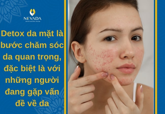 tại sao phải thải độc cho da mặt, Detox thải độc da mặt có tốt không, thải độc da mặt, cách thải độc da mặt, thải độc da mặt tại spa, thải độc da mặt có tốt không, thải độc da mặt là gì, thải độc da mặt có tác dụng gì