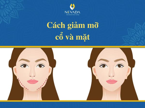 cách giảm mỡ cổ và mặt, bài tập giảm mỡ mặt và cổ, cách giảm mỡ ở mặt và cổ, giảm mỡ vùng cổ và mặt