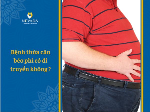 Bệnh thừa cân béo phì có di truyền không?