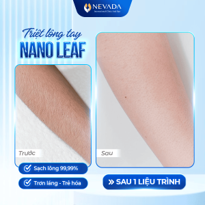triet-long-nano-leaf-1