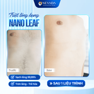 triet-long-nano-leaf-3