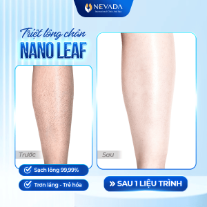 triet-long-nano-leaf-4