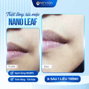triet-long-nano-leaf-6